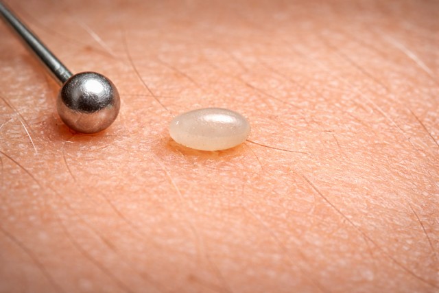 à quoi ressemble l'Œuf de puce