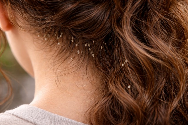 lentes de poux lentes de poux