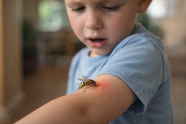 piqûre de guêpe