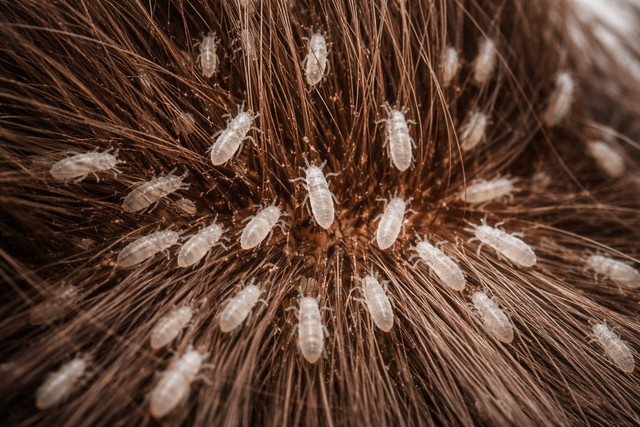 poux sur les cheveux